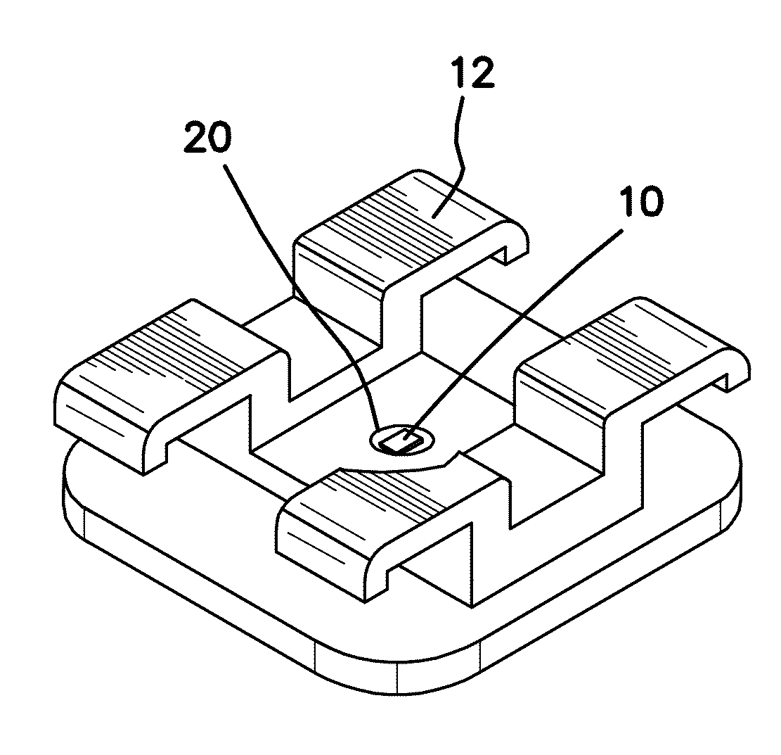 Method for Using Radio Frequency Identification Microchips in Orthodontic Brackets