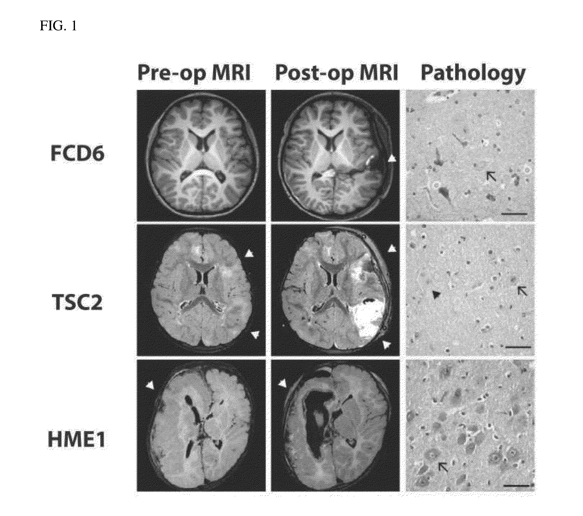 Brain somatic mutations associated to epilepsy and uses thereof