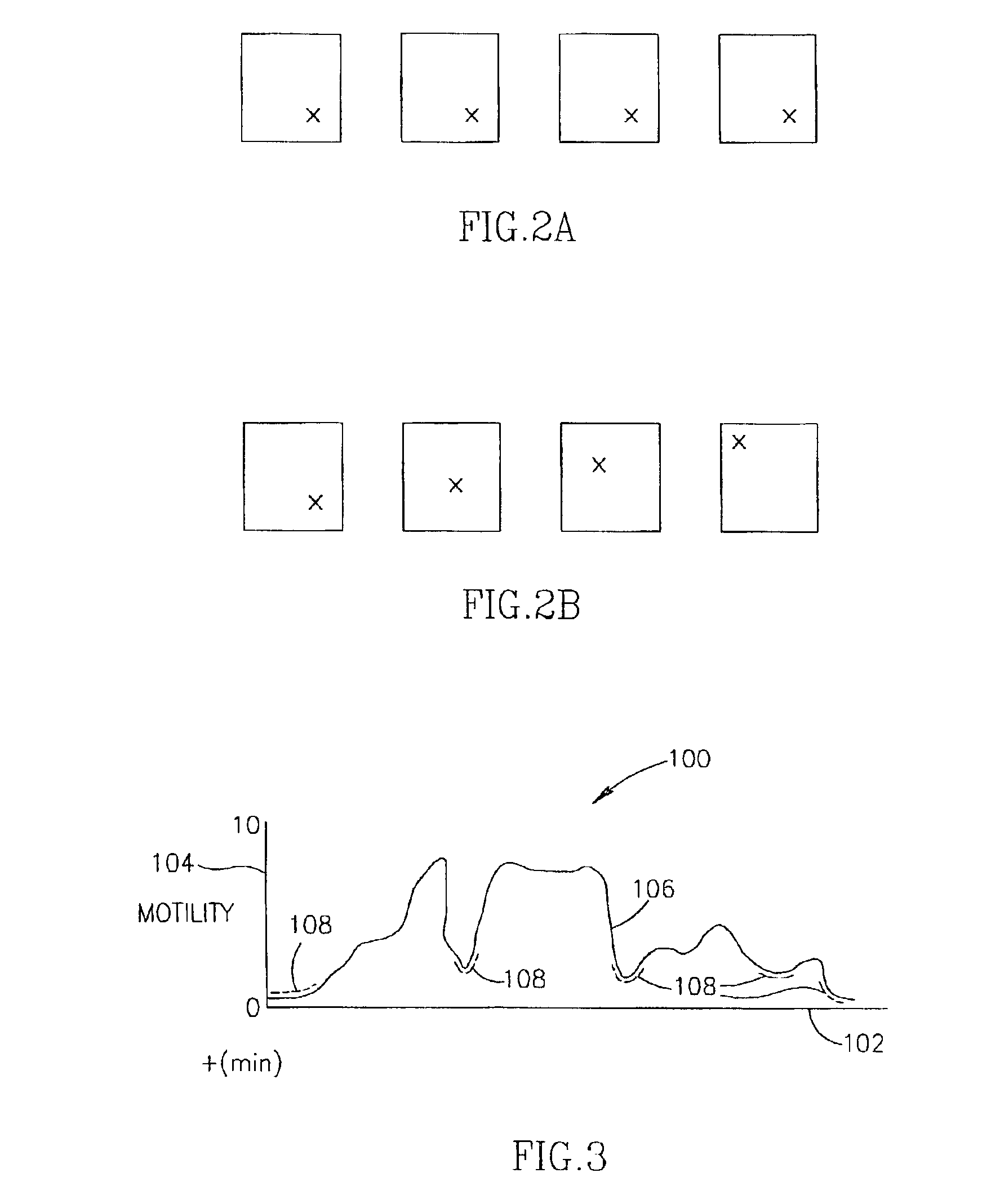 Motility analysis within a gastrointestinal tract