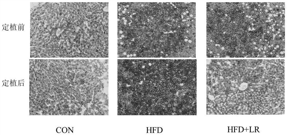 Application of Lactobacillus reuteri live bacteria in preparing medicine for treating or alleviating symptoms of non-alcoholic fatty liver disease