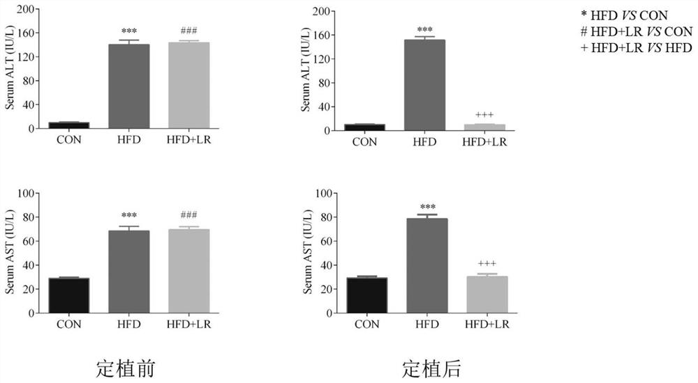 Application of Lactobacillus reuteri live bacteria in preparing medicine for treating or alleviating symptoms of non-alcoholic fatty liver disease