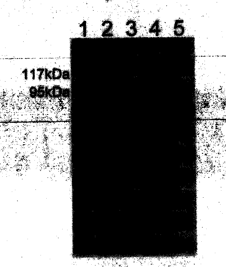 Therapeutic hepatitis B vaccine