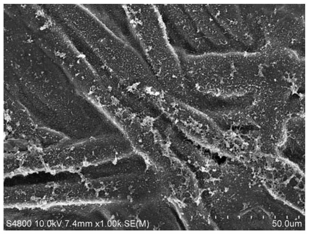 A kind of forward osmosis composite membrane and its preparation method and application