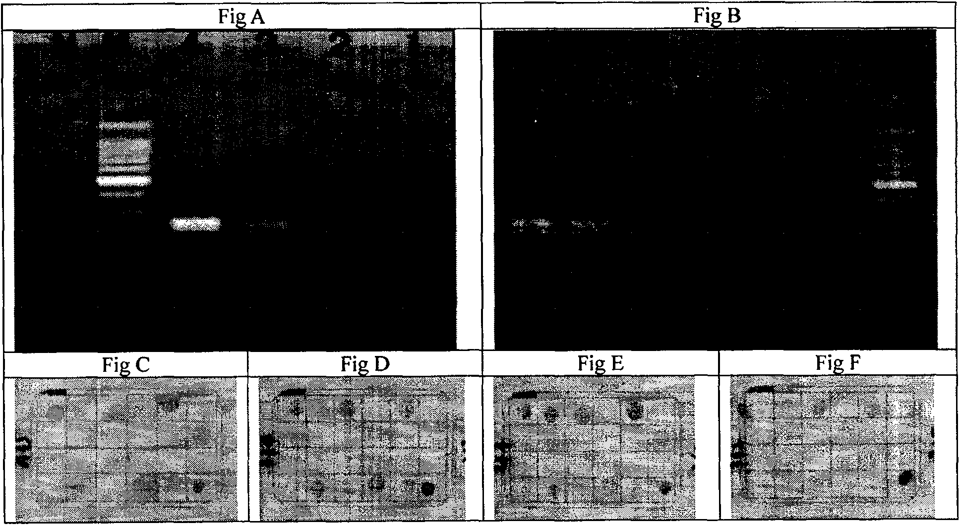 Method and kit for detecting mycobacterium tuberculosis and drug-resistant gene mutation thereof