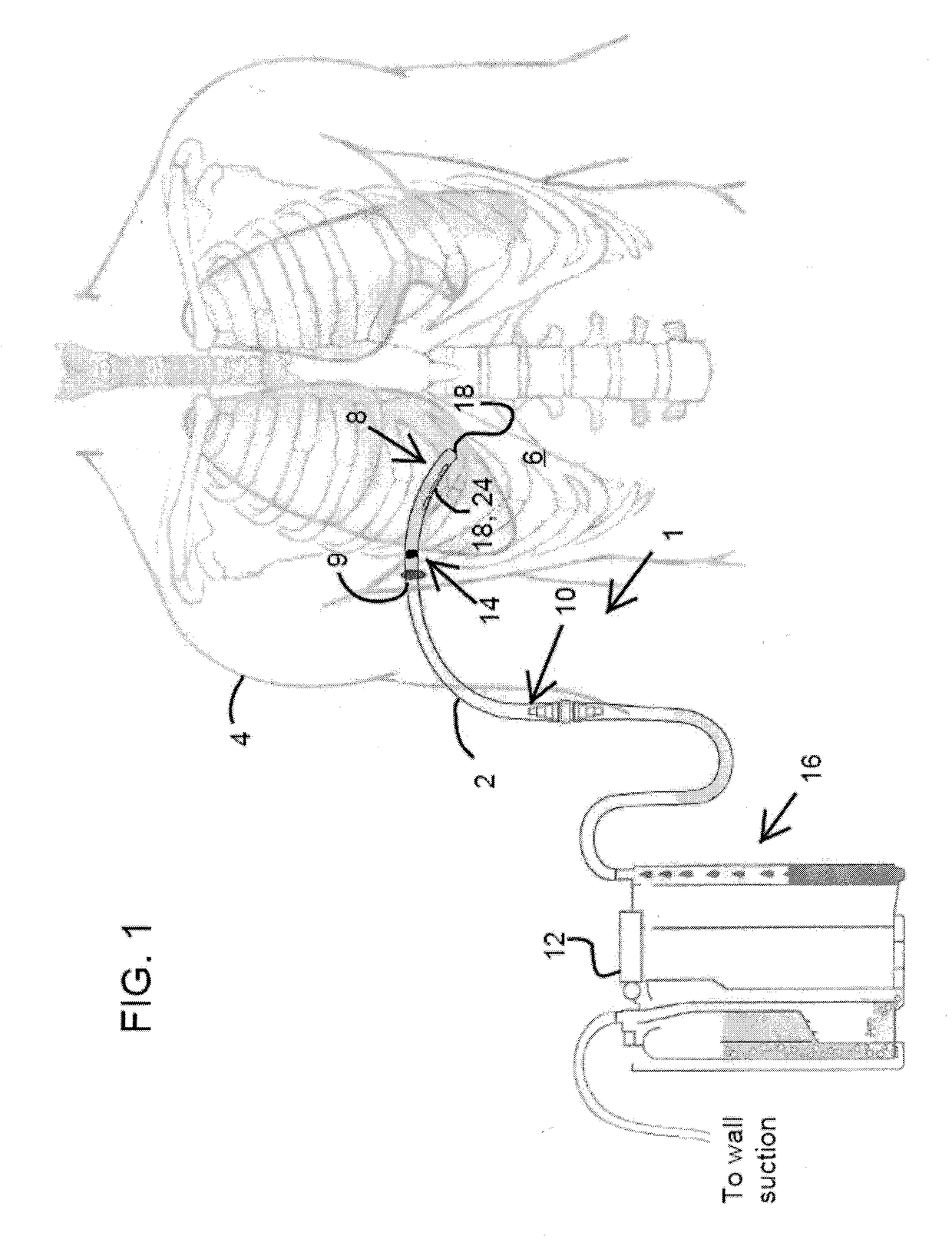 Thoracic catheter device