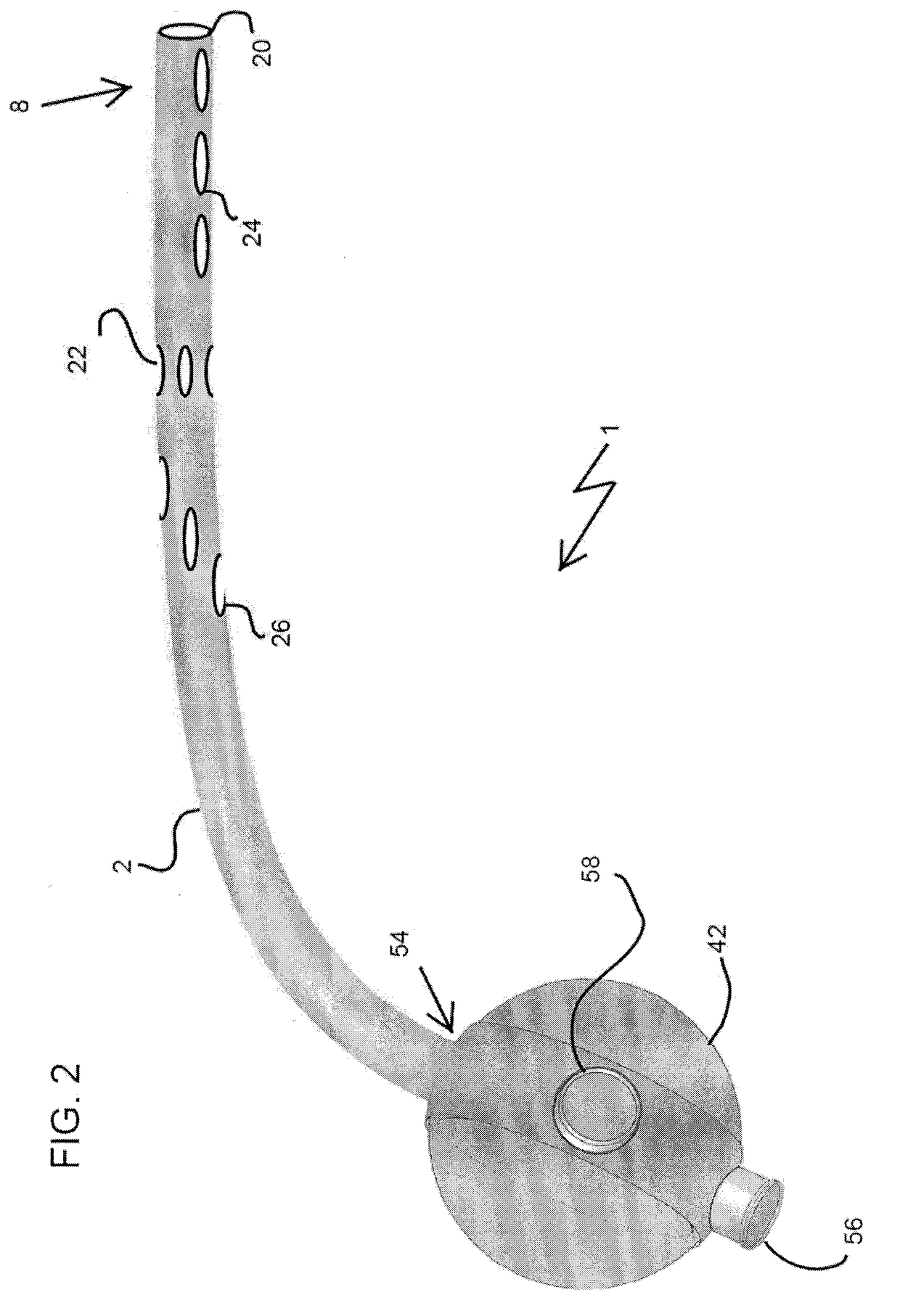 Thoracic catheter device