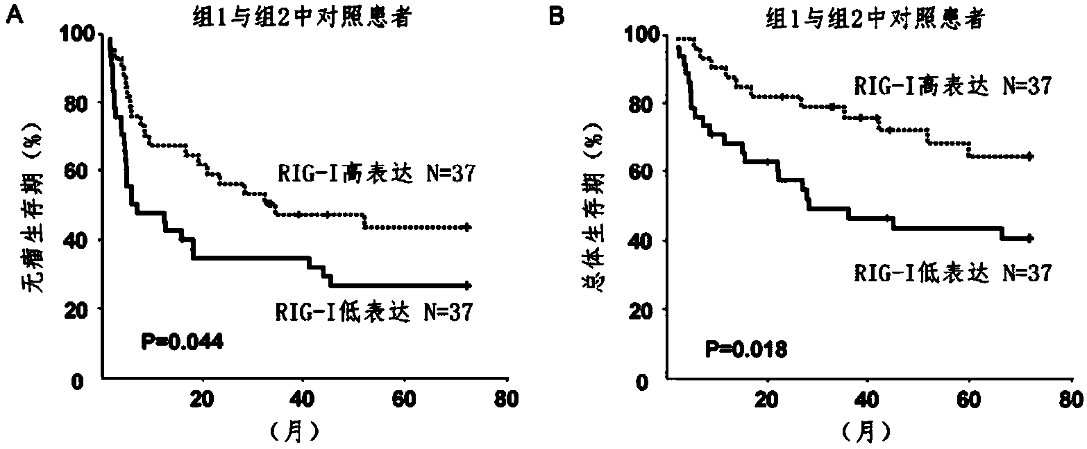 Application of pattern recognition receptors RIG-I in preparation of antitumor drug