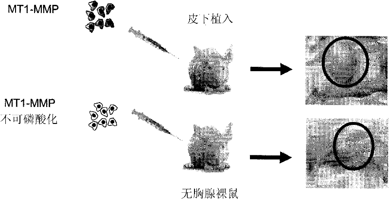 Membrane type-1 matrix metalloprotein inhibitors and uses thereof