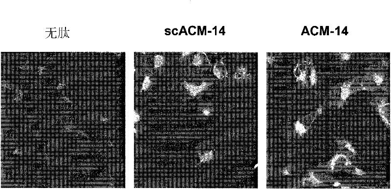 Membrane type-1 matrix metalloprotein inhibitors and uses thereof