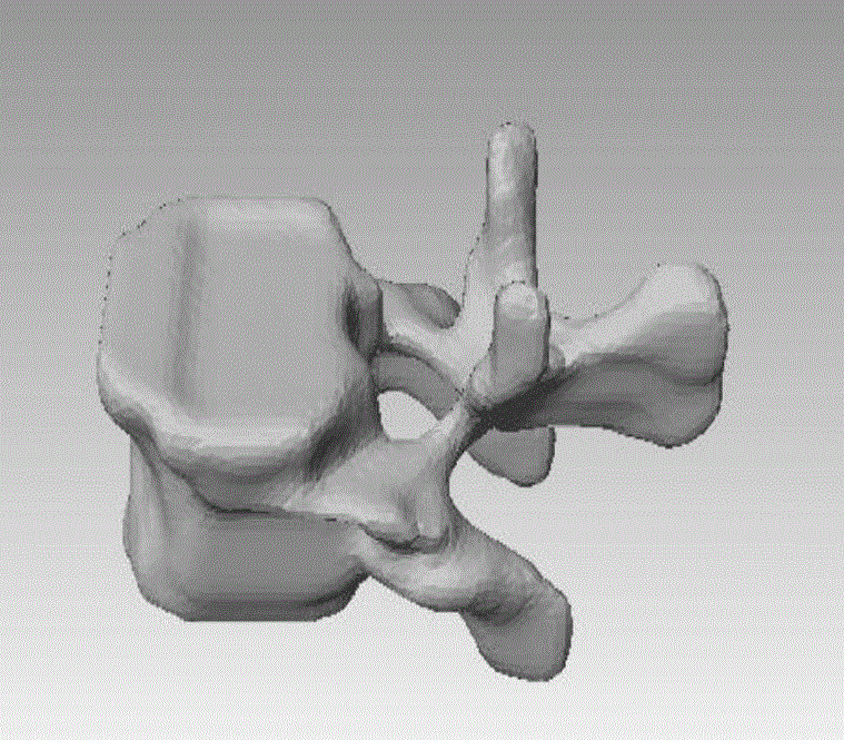 Harris-based spine feature point automatic recognizing method