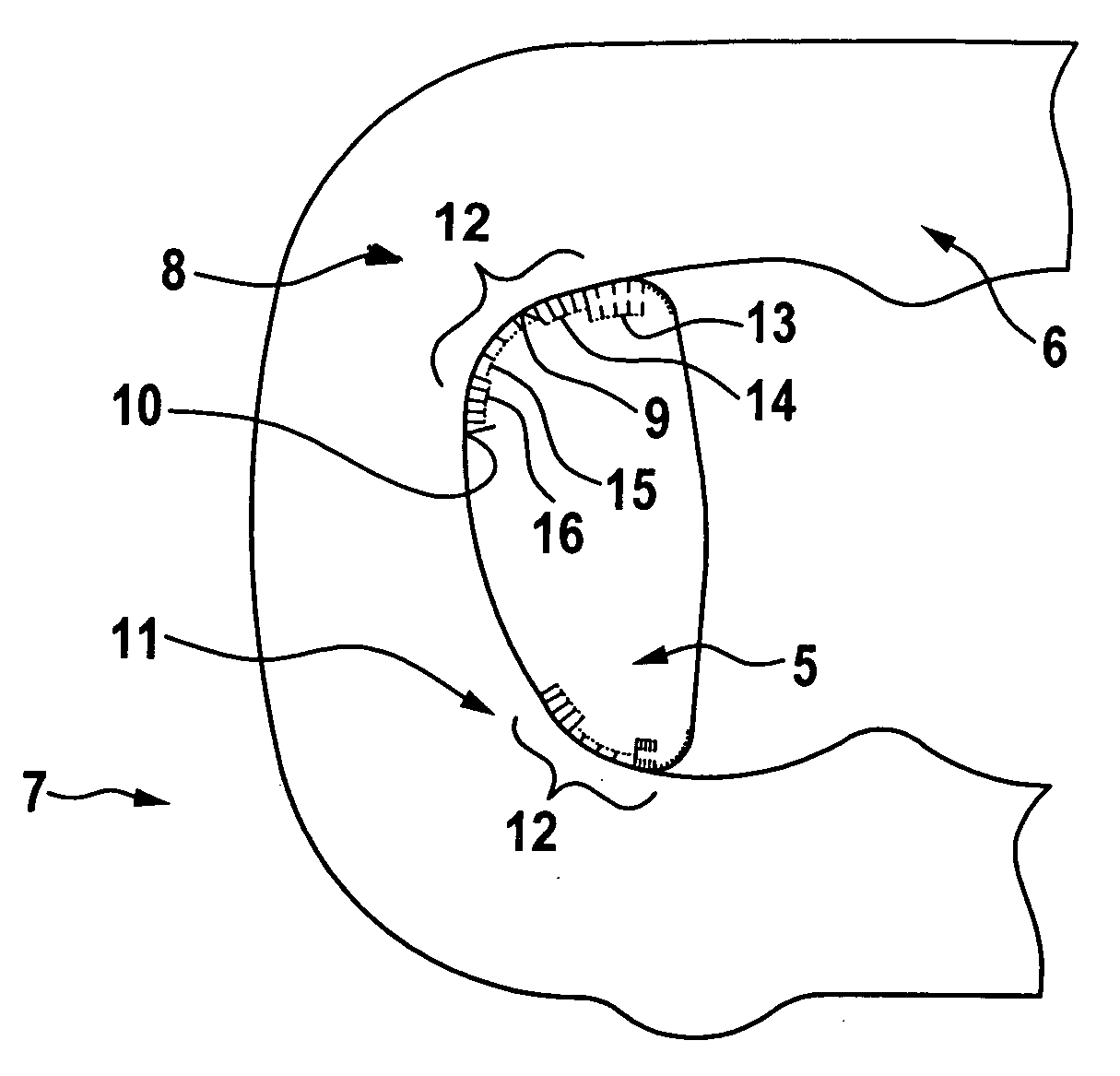 Link plate for a plate-link chain