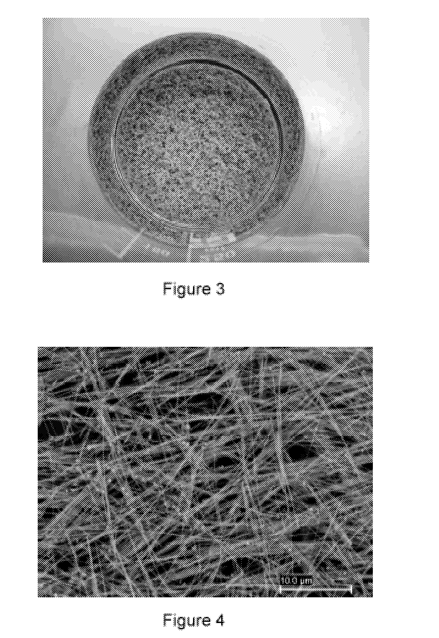 Process for preparing anisotropic metal nanoparticles