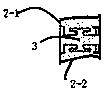 Tinnitus treatment system