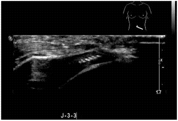 A multi-mode mammography target and a special device for releasing the target