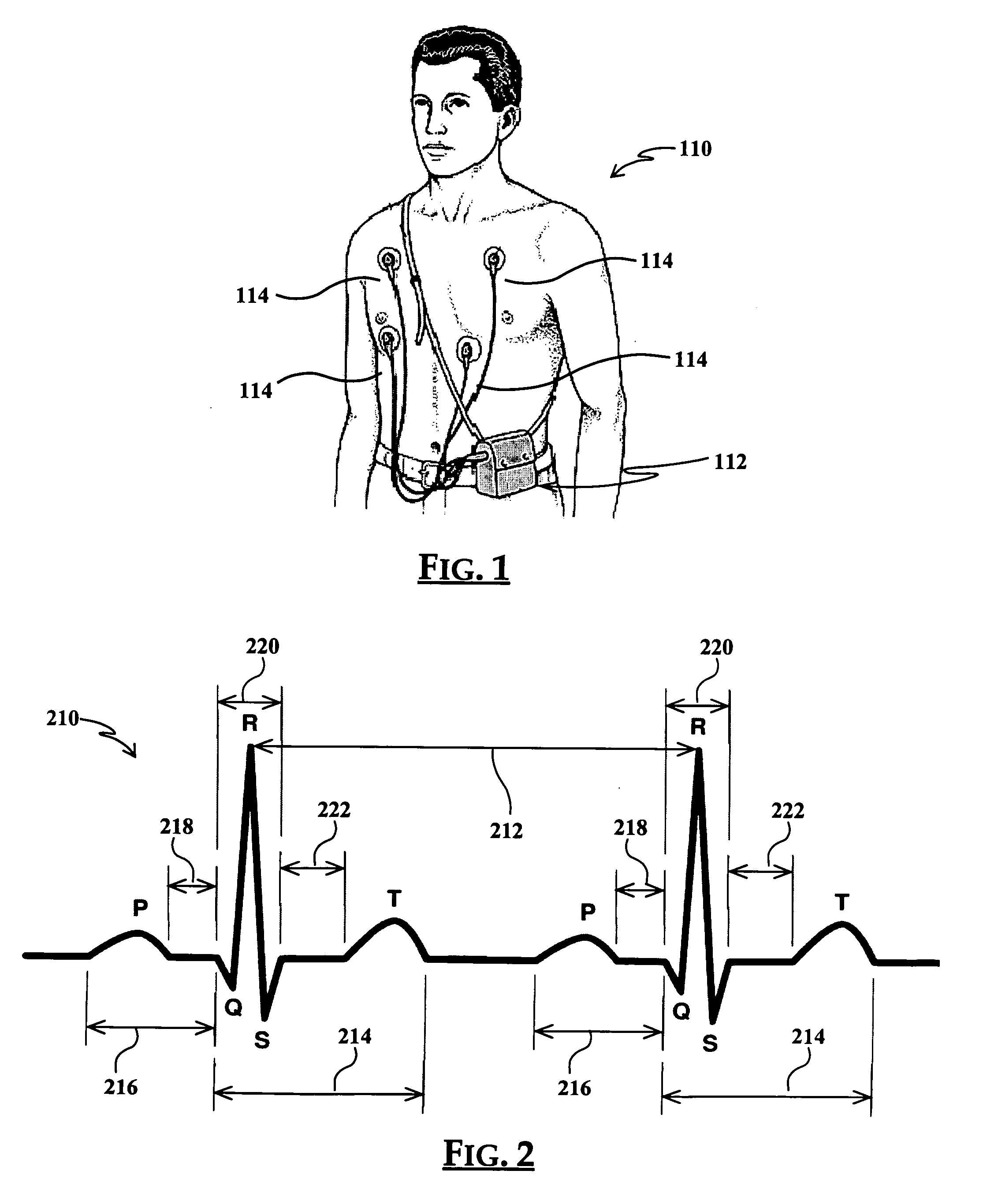 Cardiac function circadian variation analysis system and method