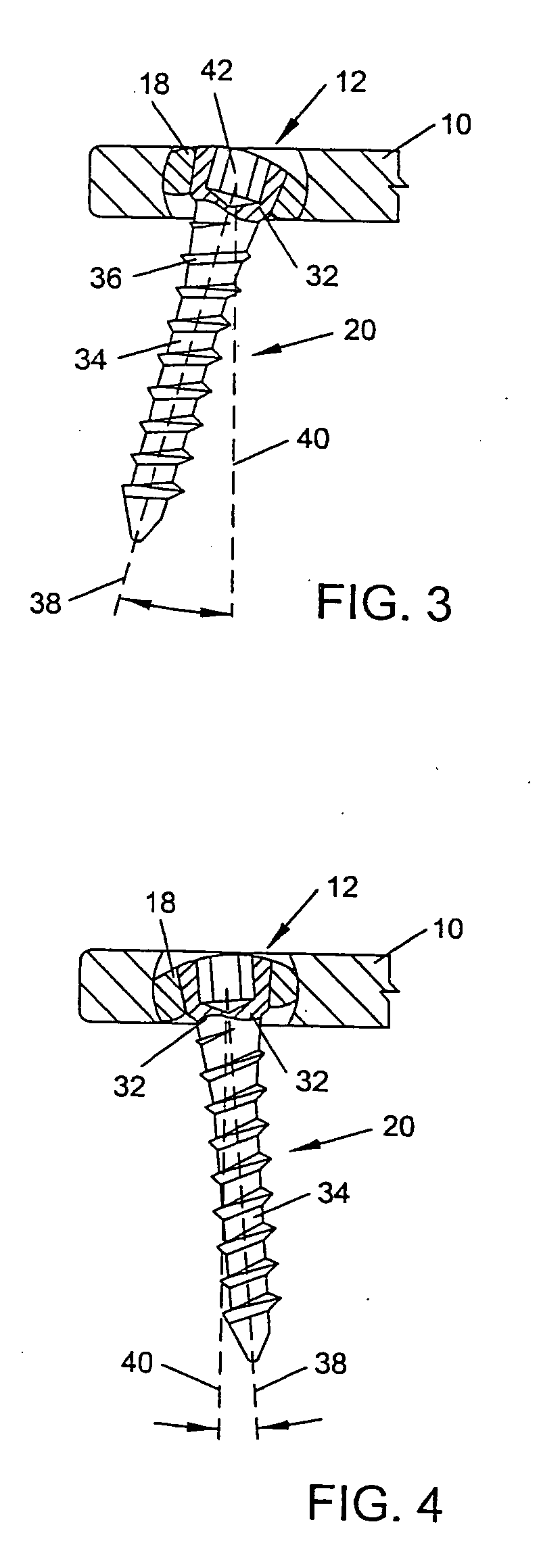 System and method for stabilizing the human spine with a bone plate