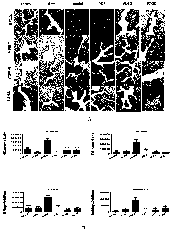 Application of polydatin in preparation of drug for treating and preventing intrauterine adhesions