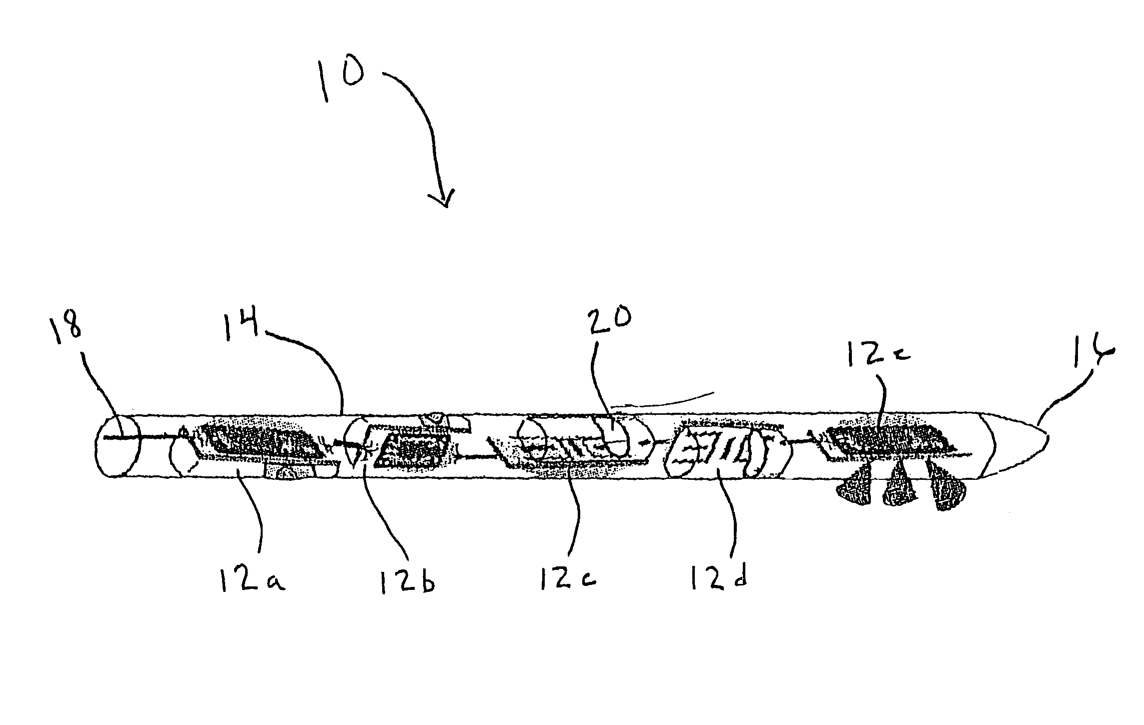 Implantable multi-parameter sensing system and method