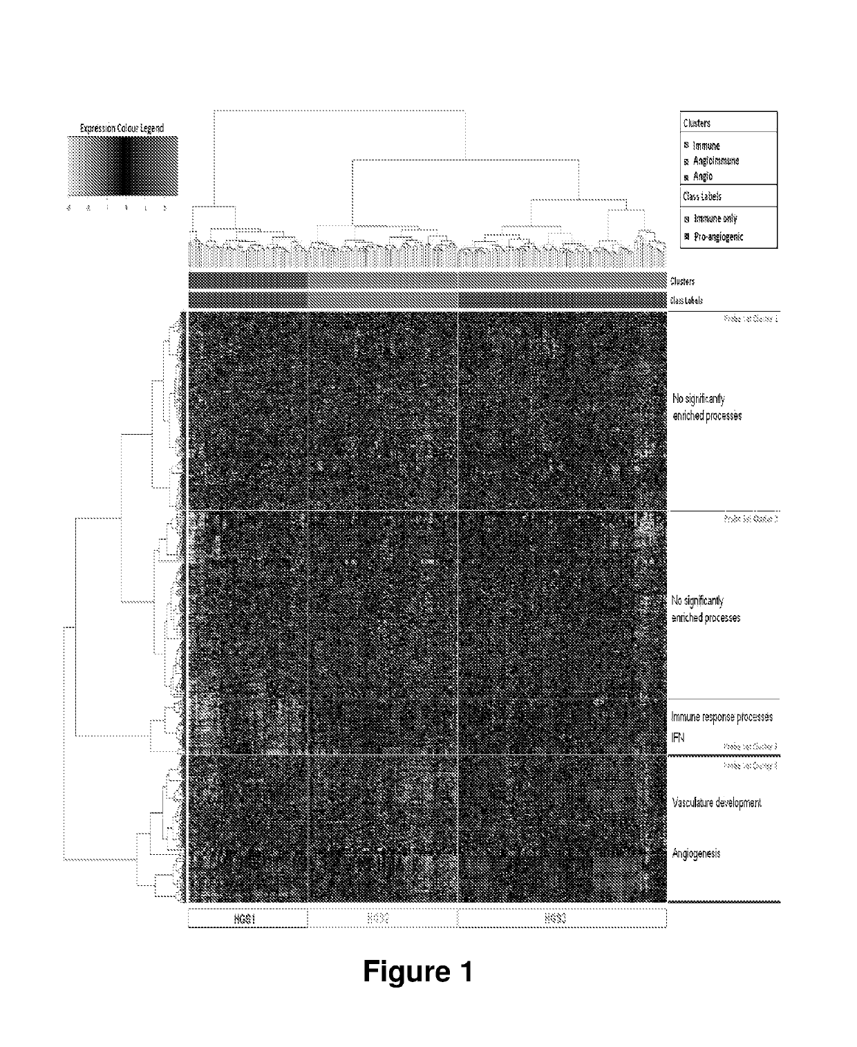 Molecular diagnostic test for predicting response to anti-angiogenic drugs and prognosis of cancer