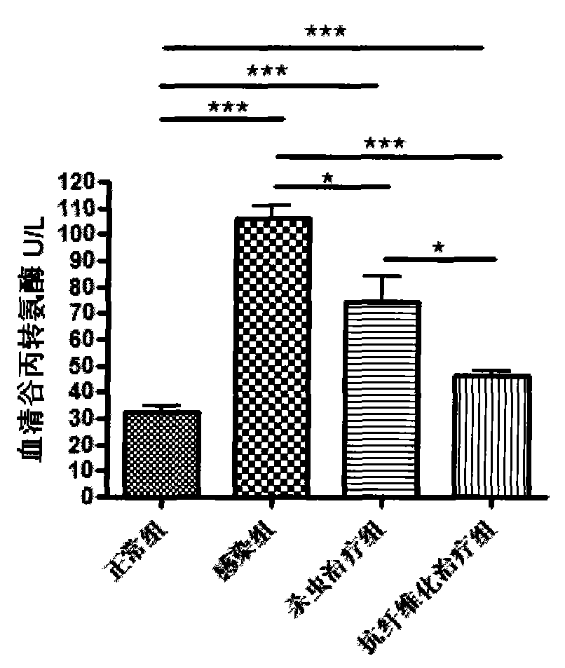 Application of praziquantel in preparing medicines for resisting Japanese schistosomiasis liver fibrosis