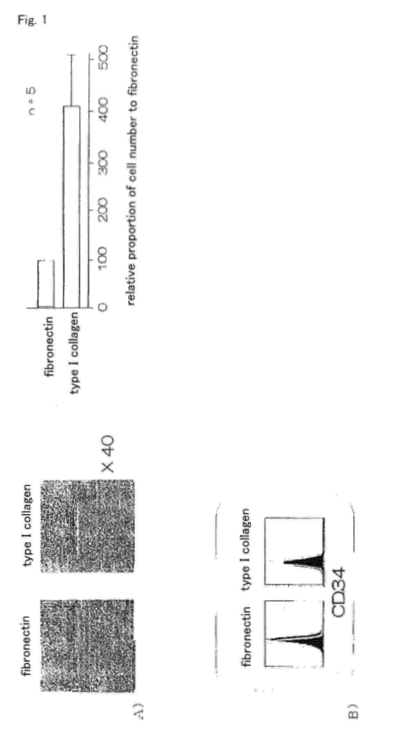 Method for efficient production of monocyte-derived multipotent cell (MOMC)