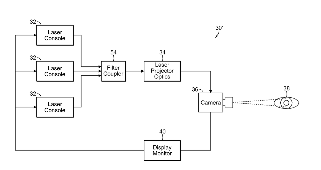 System and process for treatment of myopia