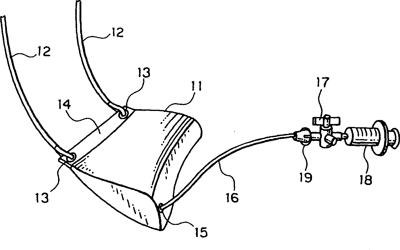 Auxiliary device for pulsatile coronary artery bypass