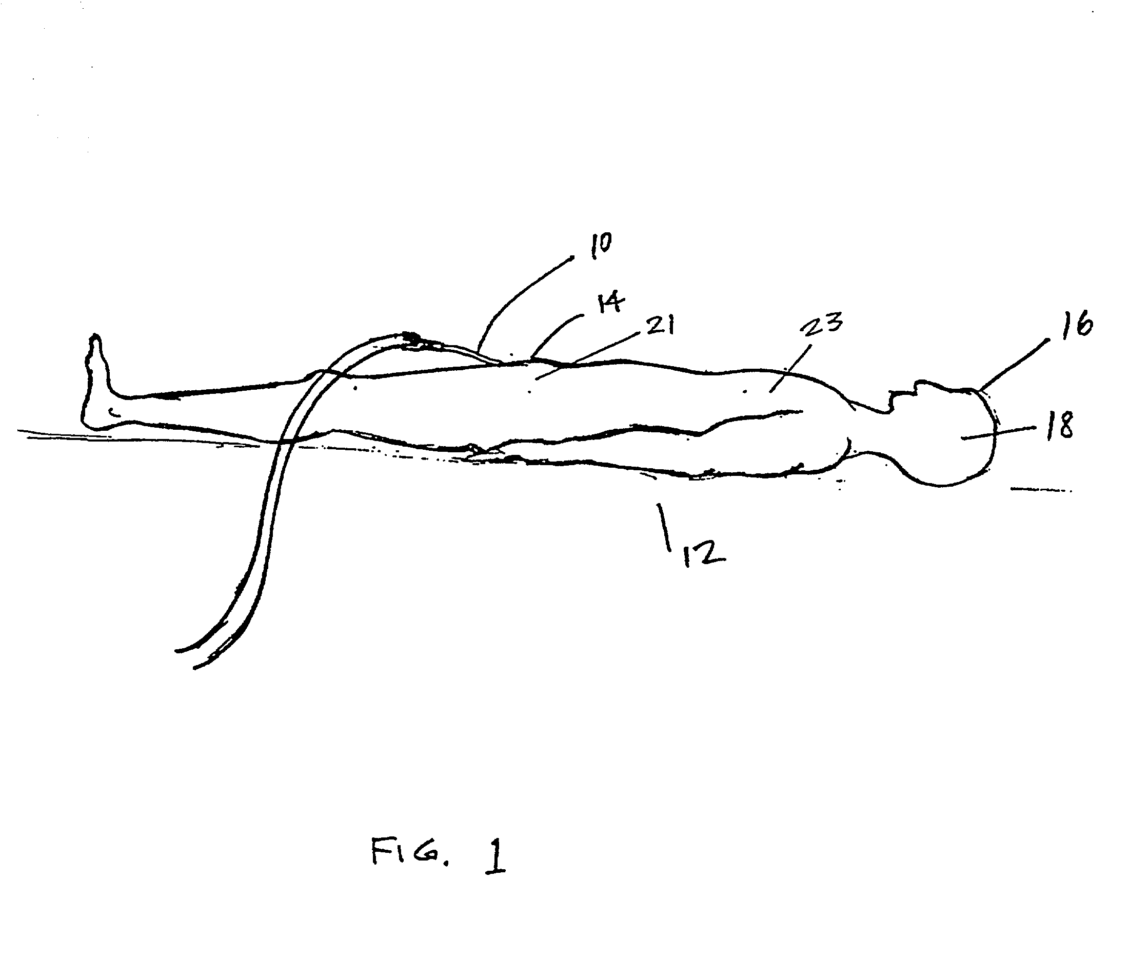 Indwelling heat exchange catheter and method of using same