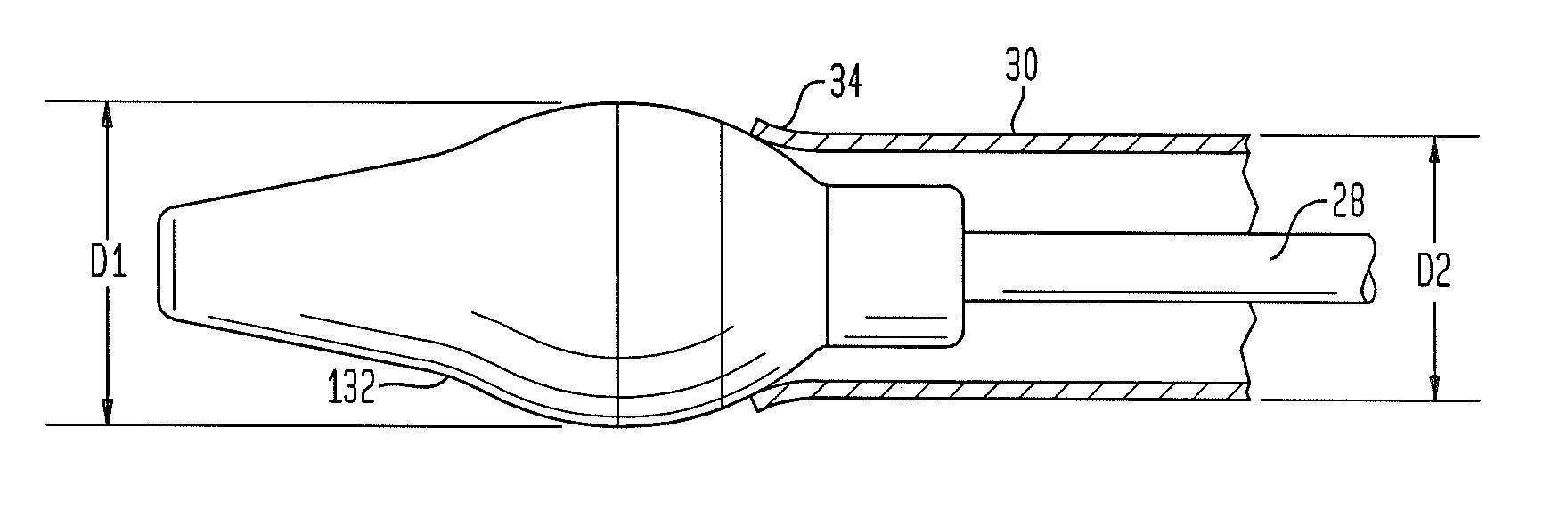 Tip for medical implant delivery system