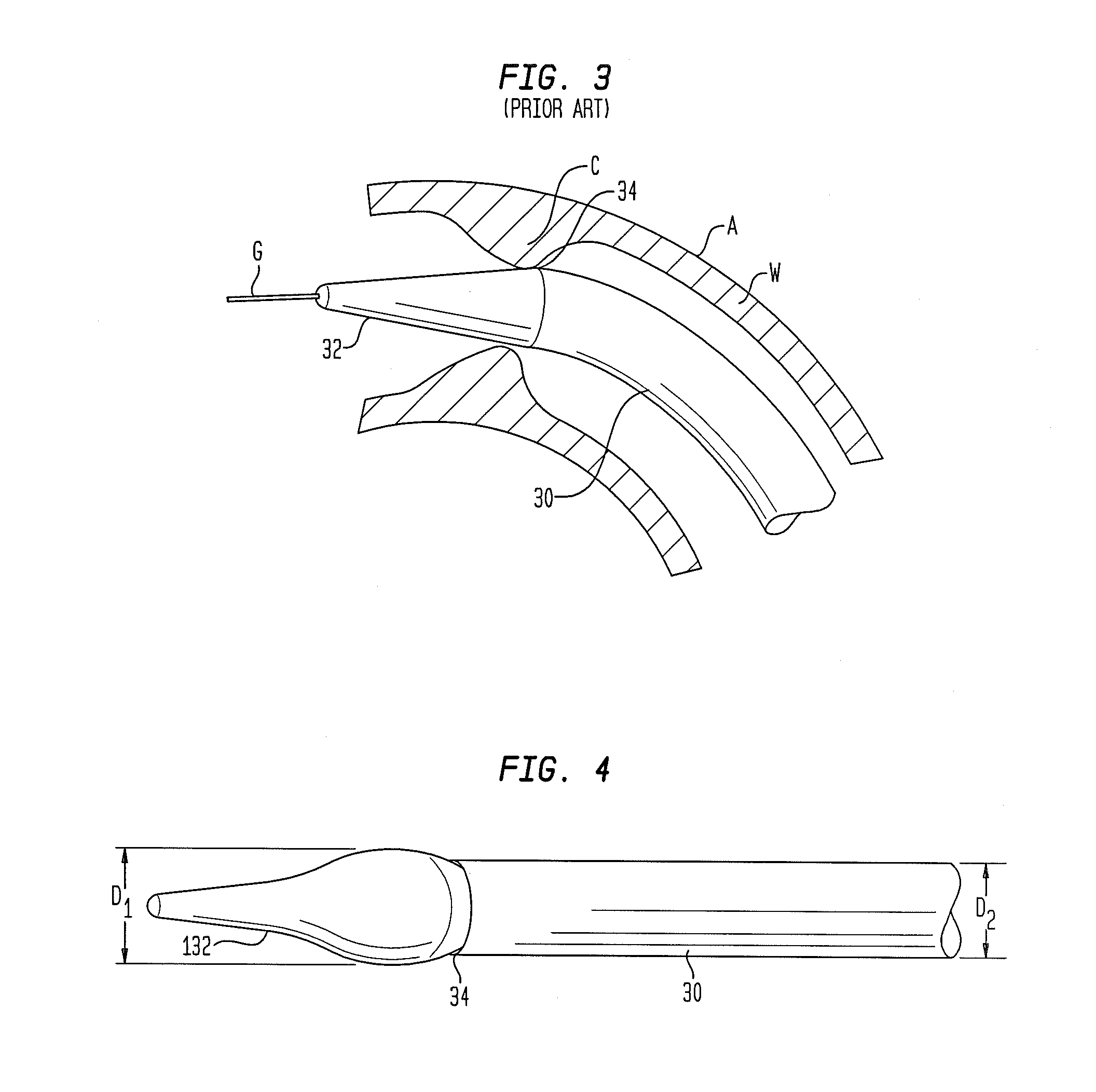 Tip for medical implant delivery system