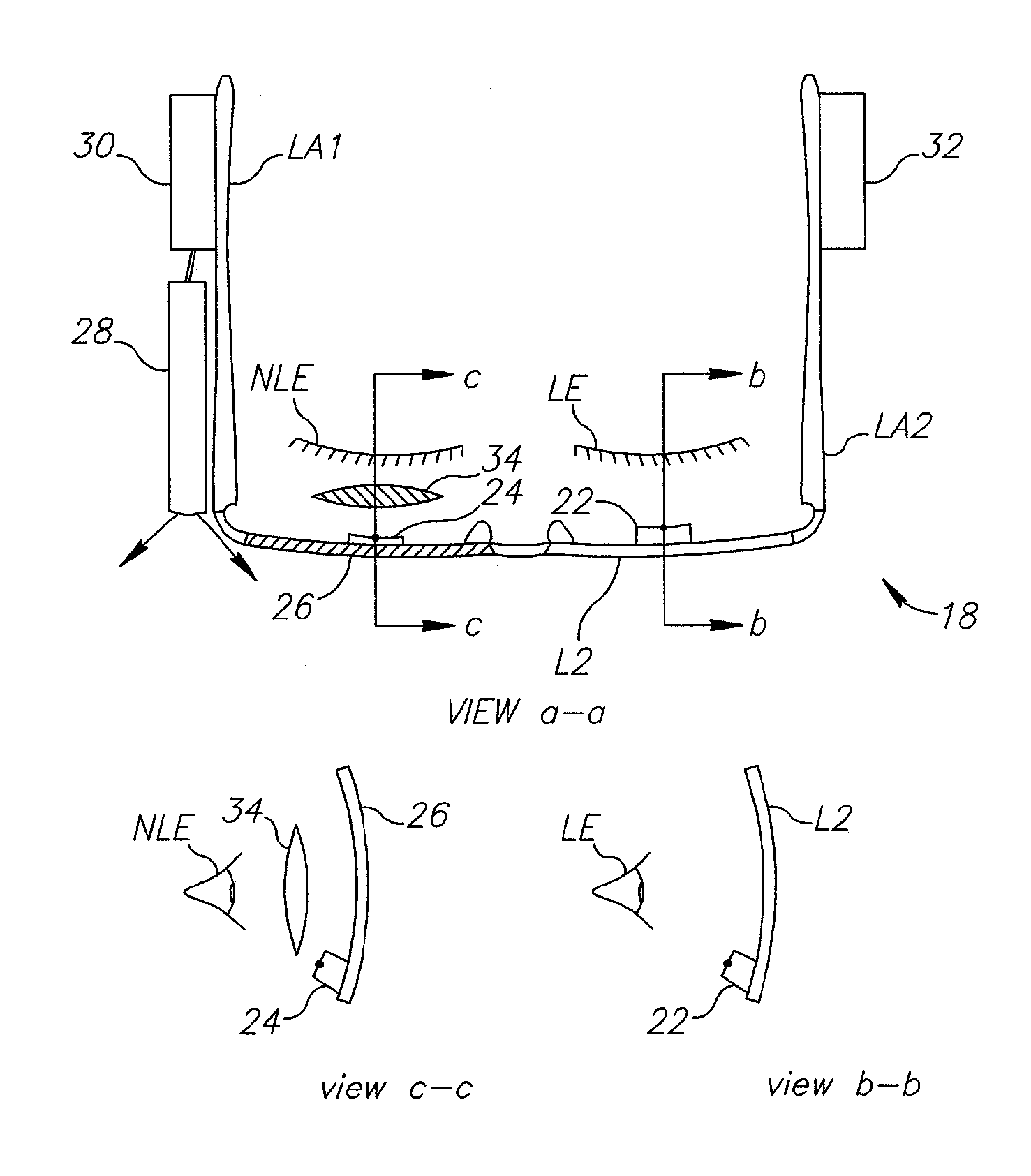 Method and system for treatment of visual impairment