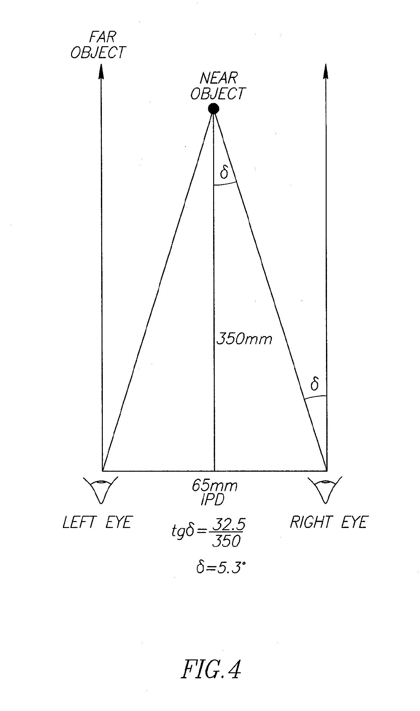 Method and system for treatment of visual impairment