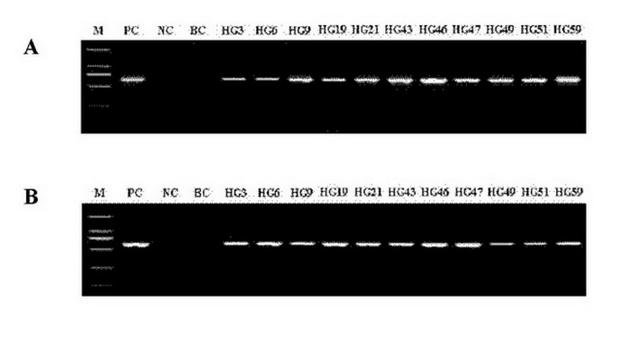 Method for increasing tanshinone content of salvia miltiorrhiza hairy roots by transferring SmGGPPS gene