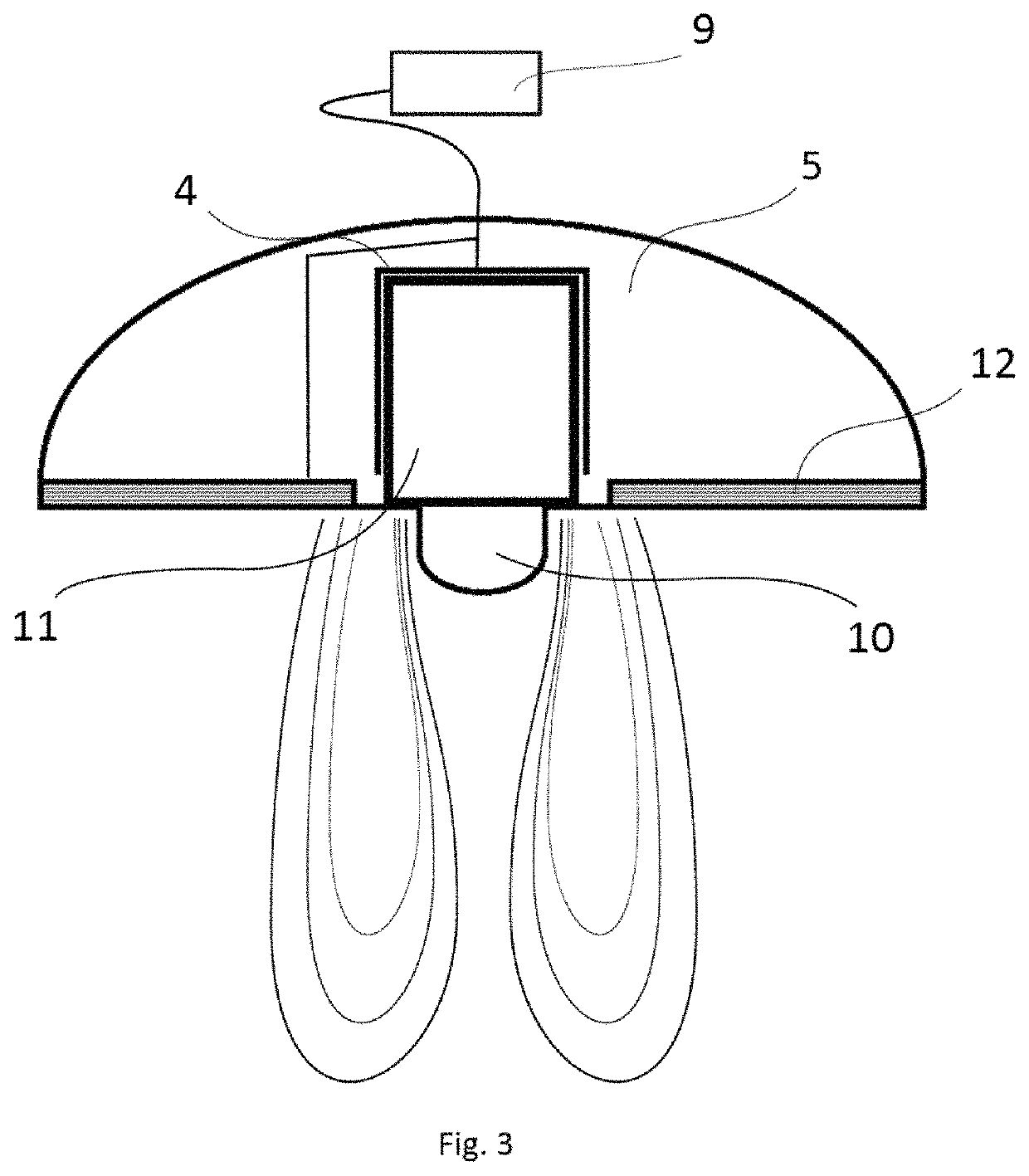 Method for a neuromodulation treatment