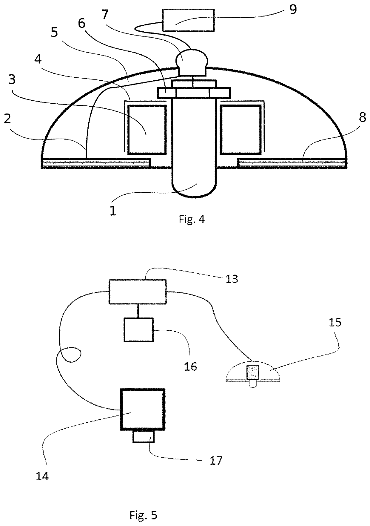 Method for a neuromodulation treatment