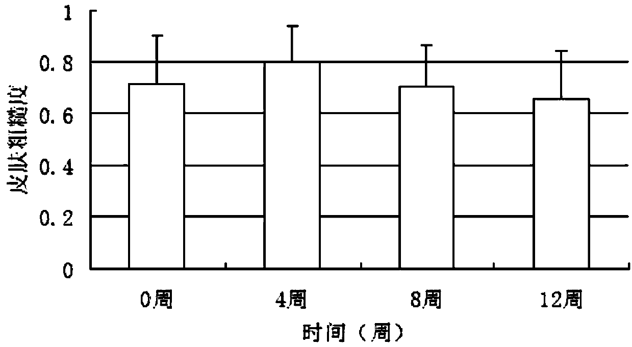 Anti-aging cream of lucid ganoderma and preparation method thereof