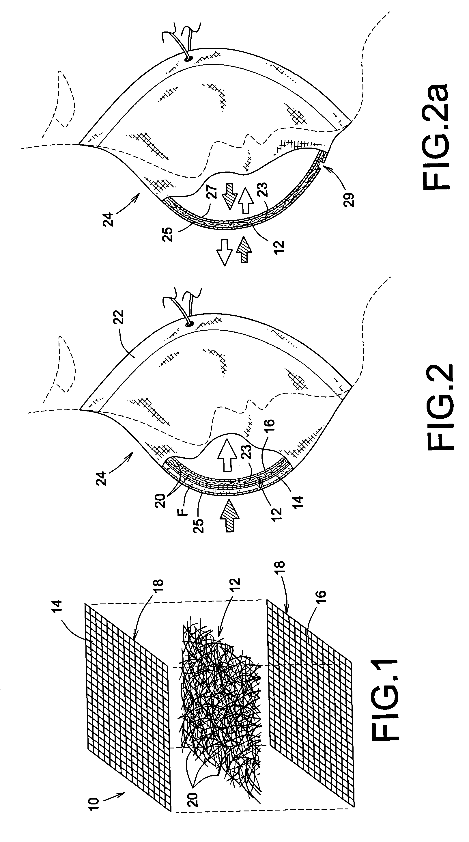 Microbicidal air filter