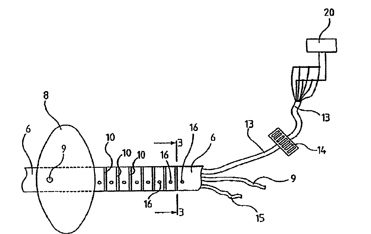 Urological balloon catheter