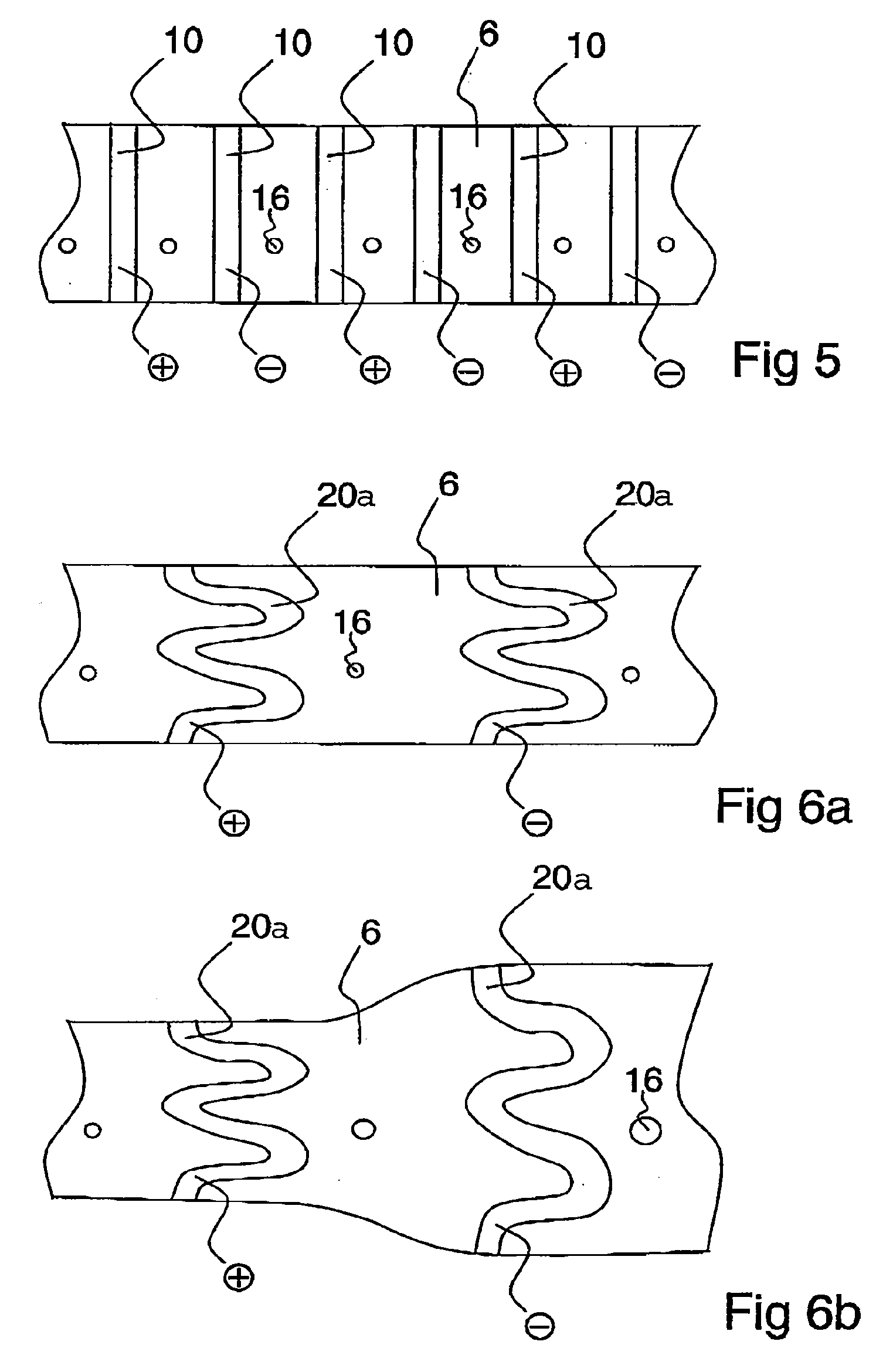 Urological balloon catheter