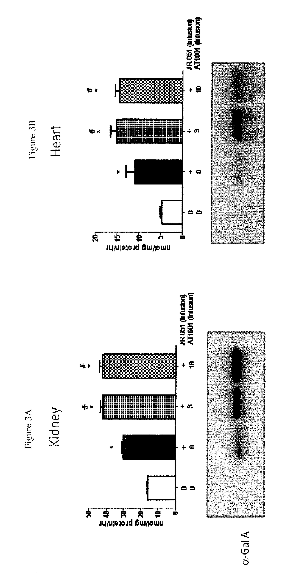 Alpha-galactosidase A and 1-deoxygalactonojirimycin co-formulation for the treatment of fabry disease