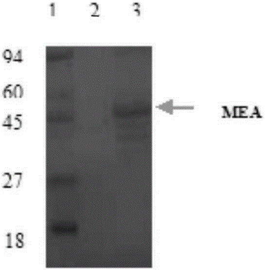 Human metapneumovirus multi-epitope antigen and application thereof