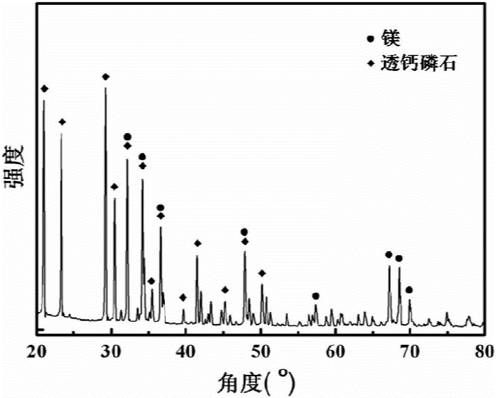 Degradable magnesium-based bone implant drug-loaded high molecular/calcium-phosphorus composite coating and preparation method