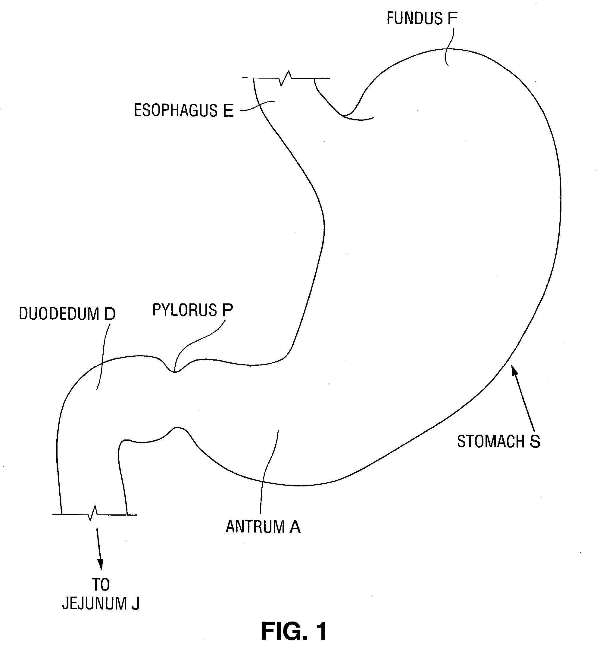 Satiation devices and methods