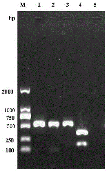 PCR-RFLP primer for distinguishing DHV-1 and new serotype and method