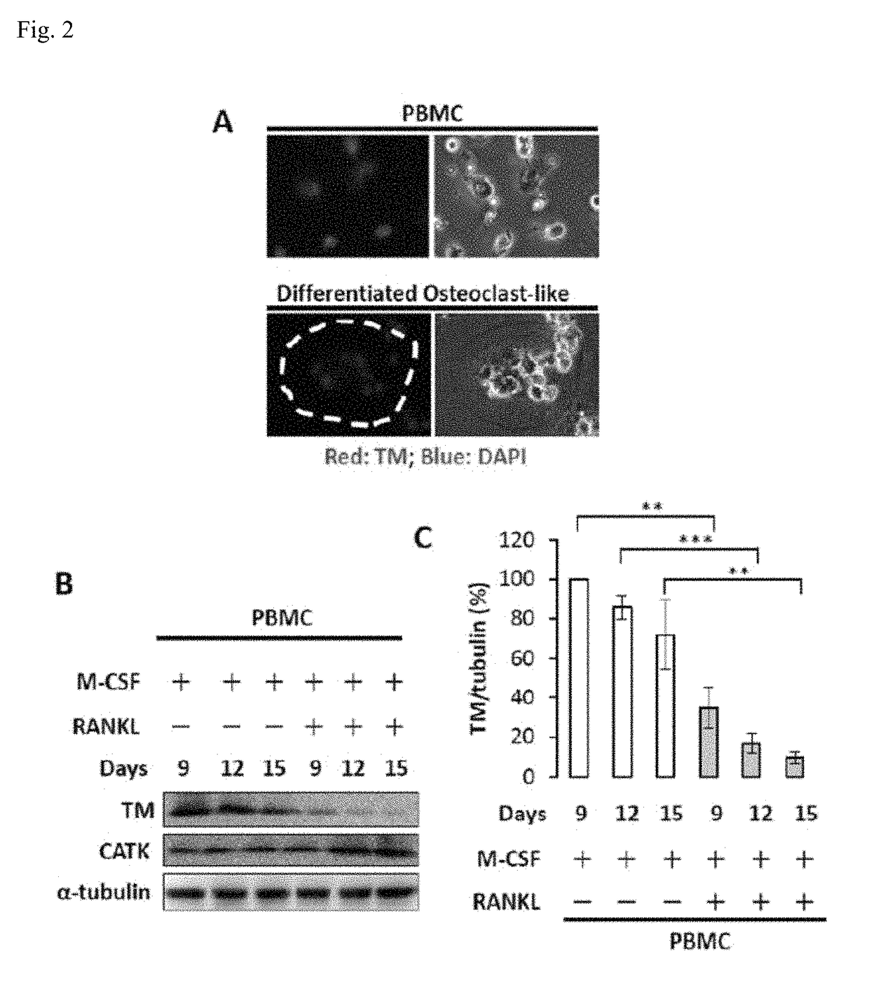 TMD1 protein for treating bone loss diseases