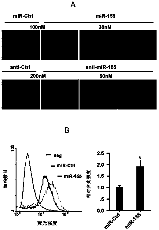 Method for preventing and treating atherosclerosis through inhibition of micro-RNA155