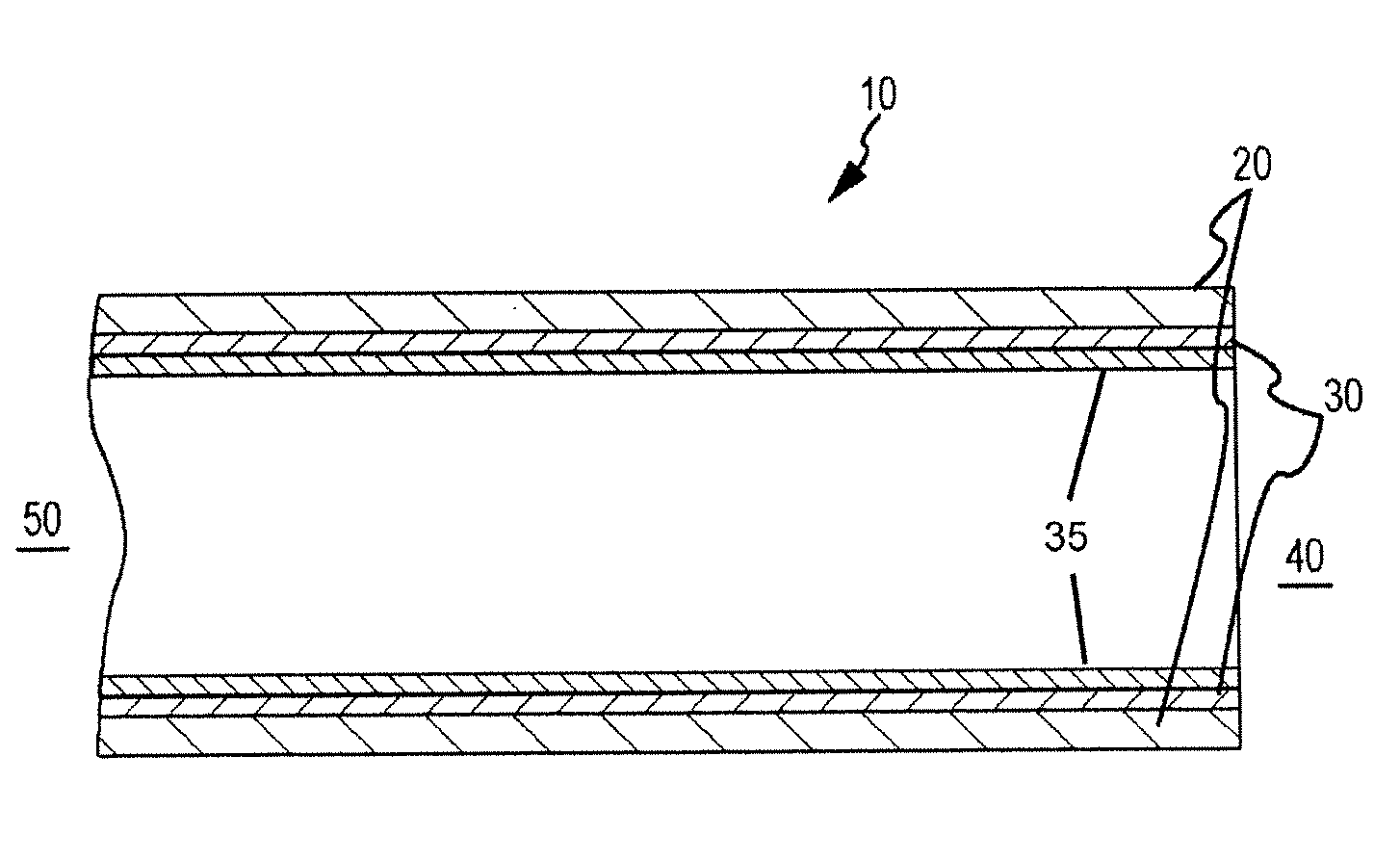 Catheter shaft and method of manufacture