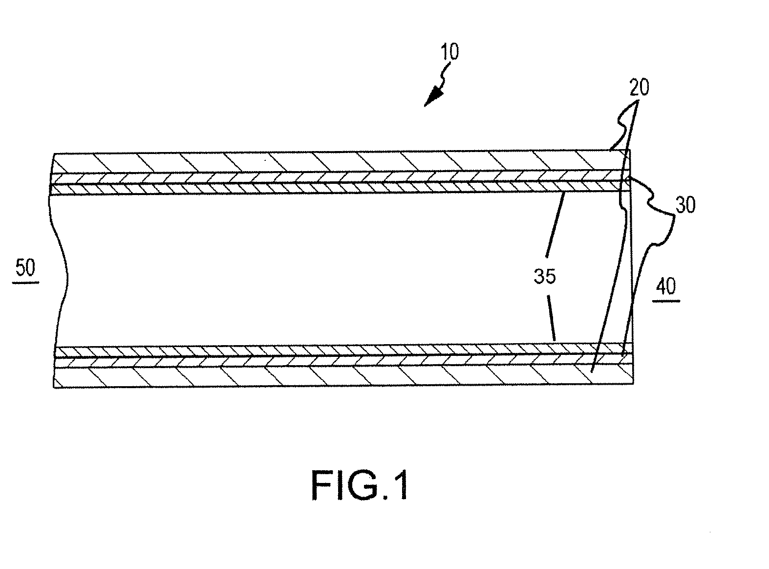 Catheter shaft and method of manufacture