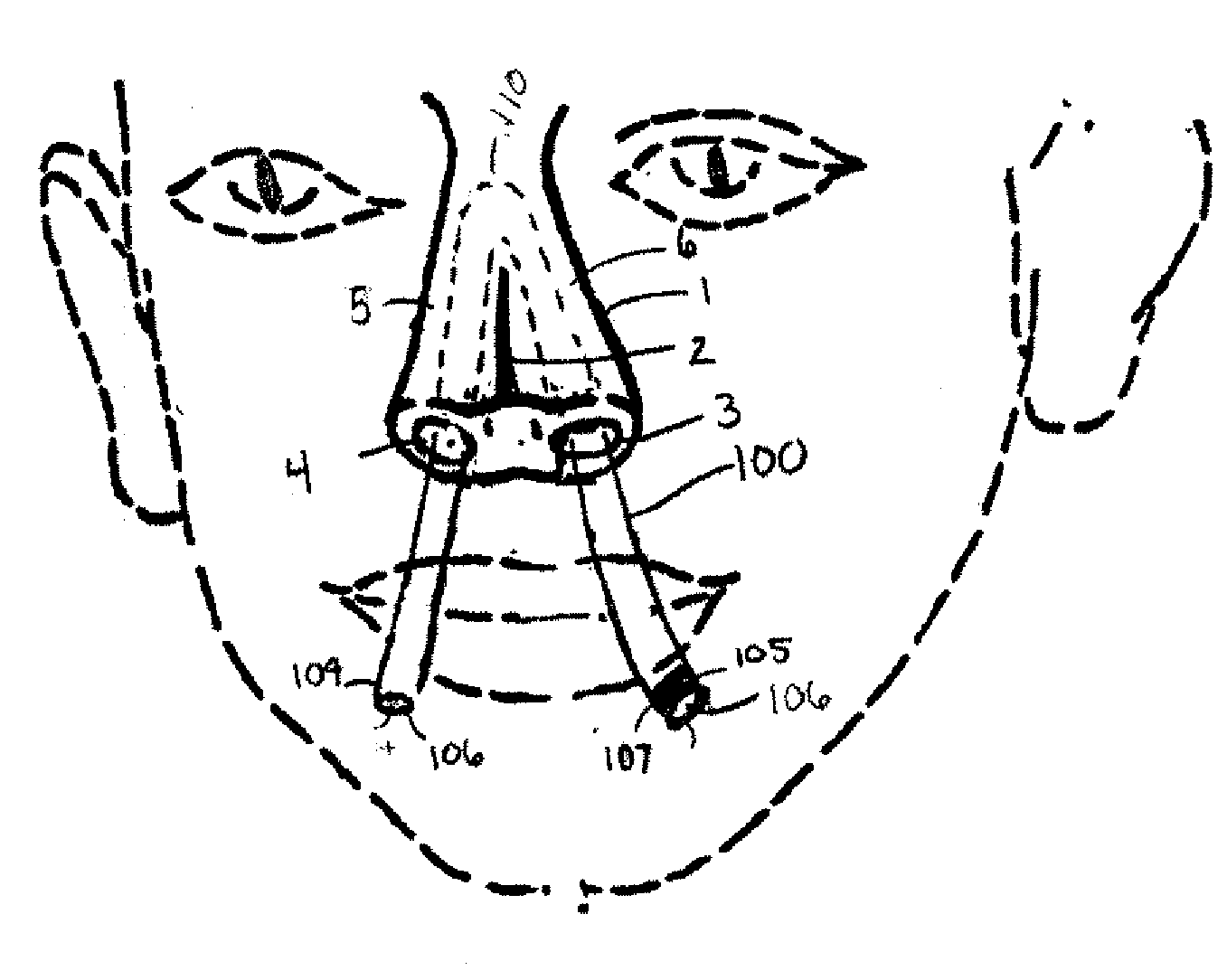 Methods and devices for non-invasive cerebral and systemic cooling