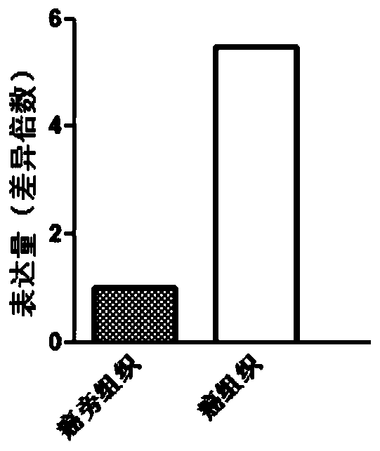 OIT3 gene for early diagnosis of thyroid cancer and application thereof